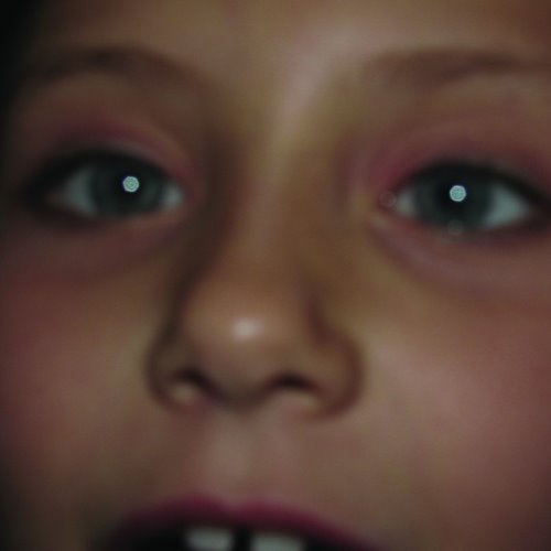 album thumb